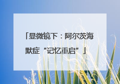 显微镜下：阿尔茨海默症“记忆重启”